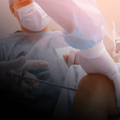 surgeons inserting a medical device into patients knee during knee surgery