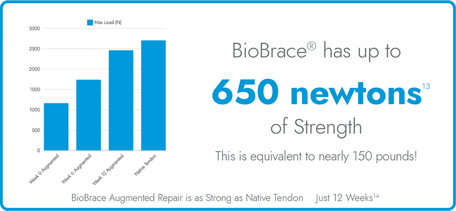 Rotatorenmanschetten-Augmentationsdiagramm 2
