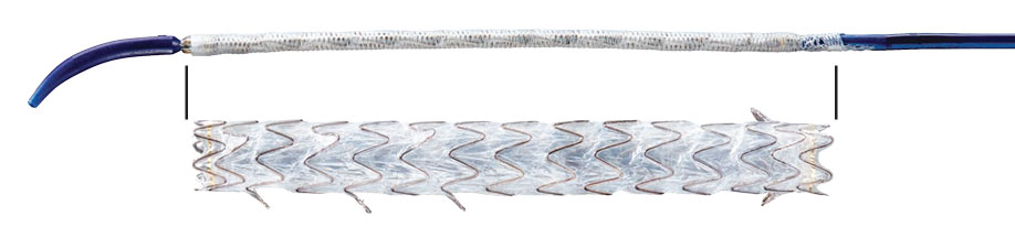 gore viabil short wire