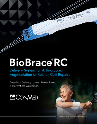 BioBrace® Brochure Cover