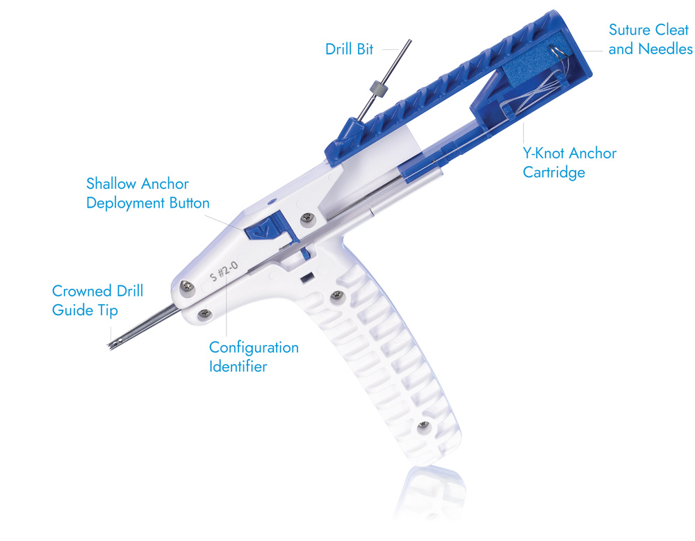 TruShot Guide with callouts to the Y-Knot Anchor Cartridge, Drill Guide Tip, and Drill Bit.