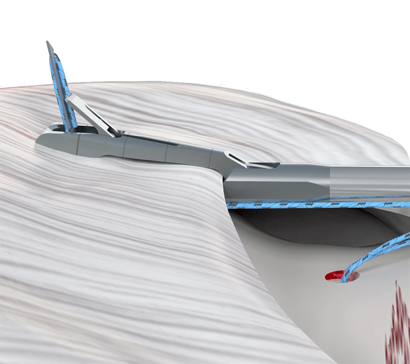 TruFire™ focus on the Rotator Cuff tissue