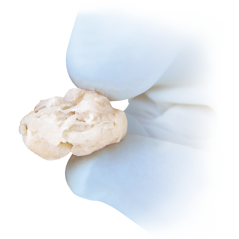 CartiMax® Viable Cartilage Allograft